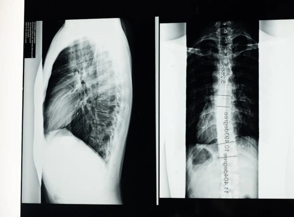 Why Gerenaldoposis Disease Is Bad
